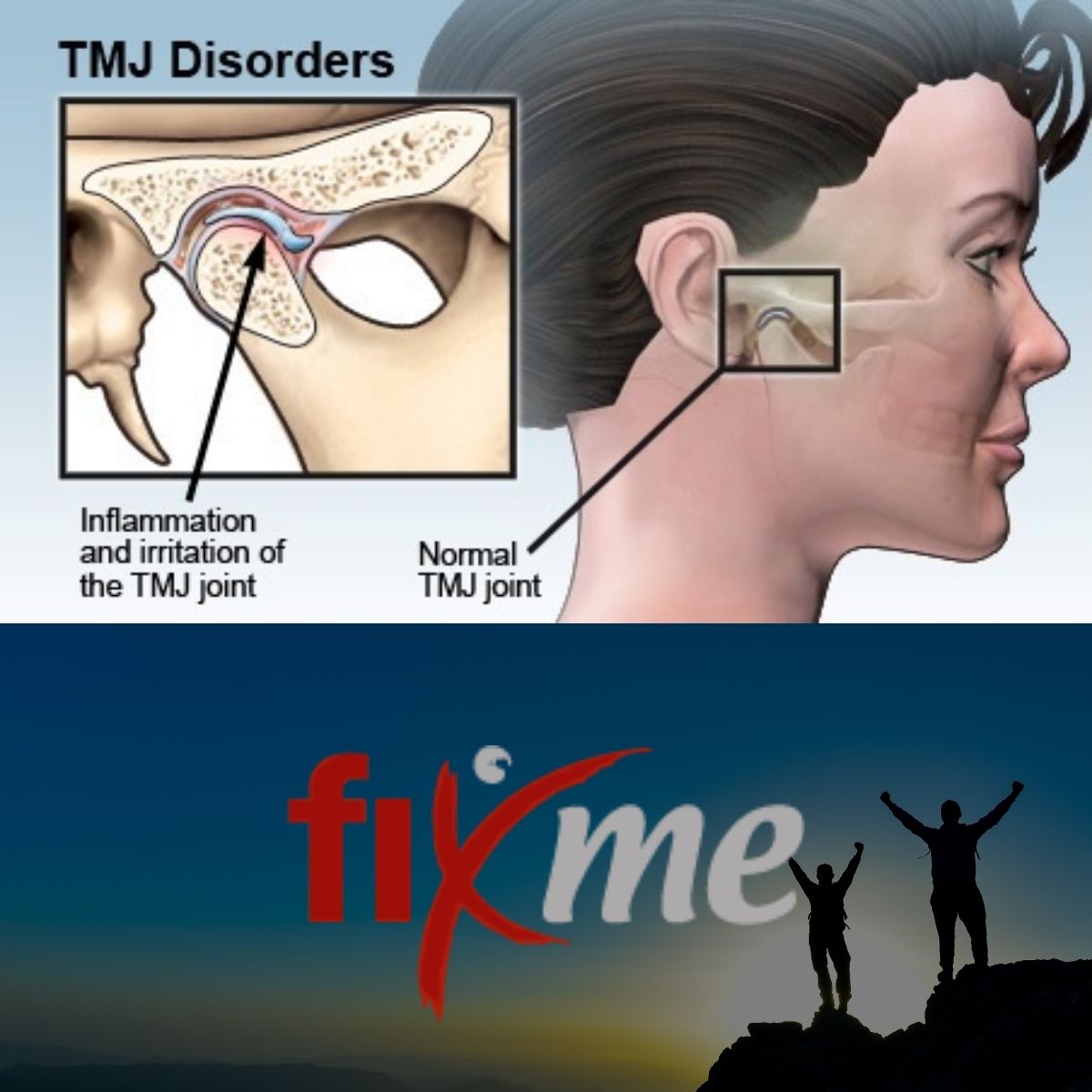 What are TMJ (temporomandibular joint) issues?